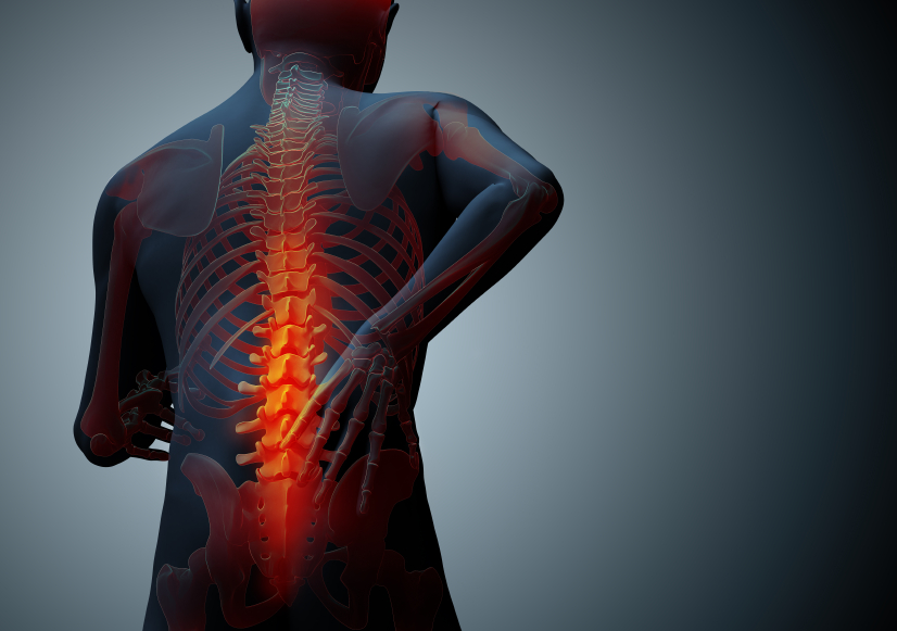 back hurt Complete Wellness Physio