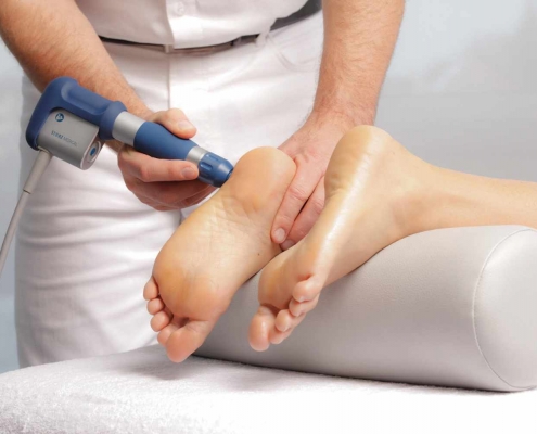 Radial Shockwave Therapy