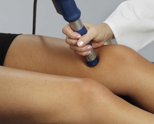 Radial Shockwave Therapy